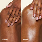 a split image shows a close-up of skin labeled “before” on the left and “after” on the right. the after image appears smoother and more radiant. a hand rests gently on the skin in both panels.