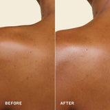 a split image shows deep-toned skin labeled “before” on the left and “after” on the right. the after image appears smoother and more luminous.
